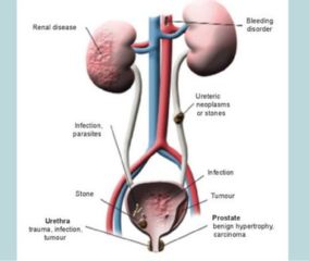 Kidney or Urinary Disorders Treatment at Anamaya Homoeocare